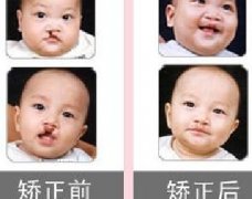 吃兔肉真的會長兔唇？為什么會長兔唇？
